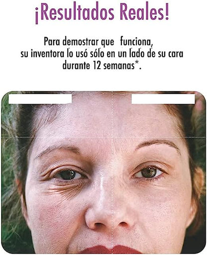 Radiofrecuencia Inova Dermawand Pro + ENVIO GRATIS